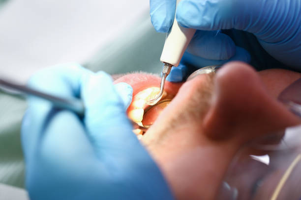 Best Emergency Dentist for Special Needs Patients in Mount Pleasant, NC