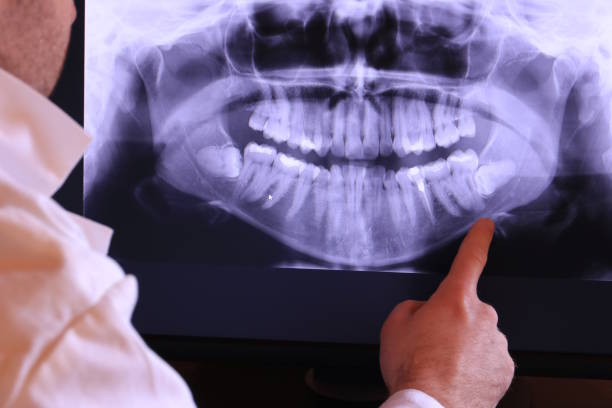 Best Emergency Dentist for Special Needs Patients in Mount Pleasant, NC