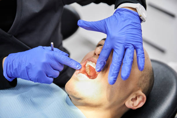 Best Emergency Dentist for Lost Fillings or Crowns in Mount Pleasant, NC